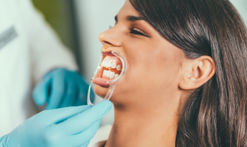 Teeth Whitening in North Salt Lake Dental
