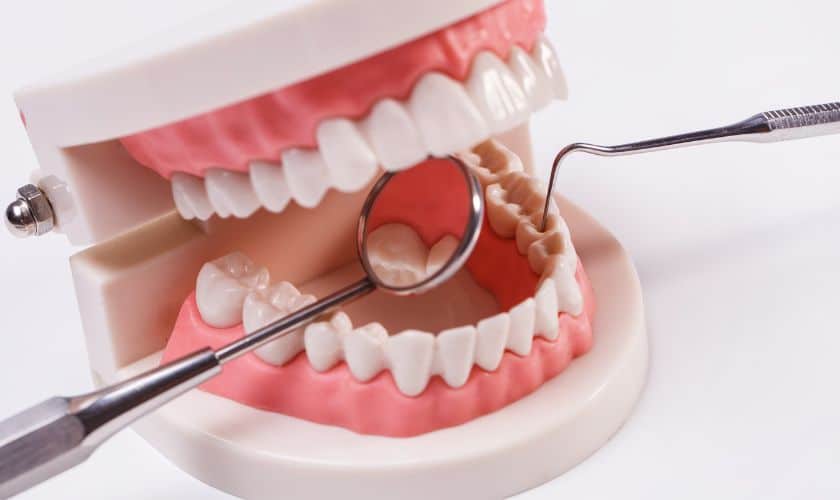 CEREC Crowns: The Future of Dental Restorations Made Simple