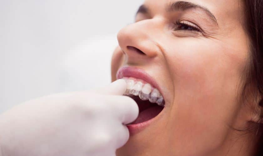 Invisalign Treatment in North Saltlake