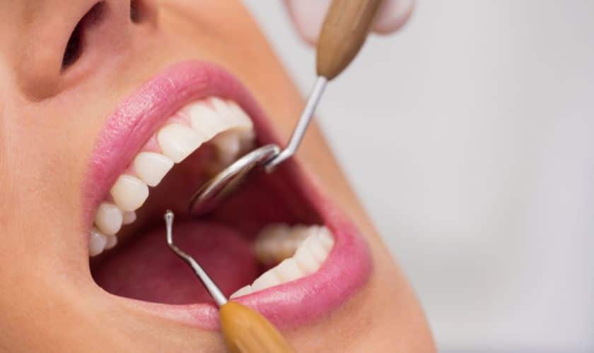 Teeth Whitening In North Salt Lake