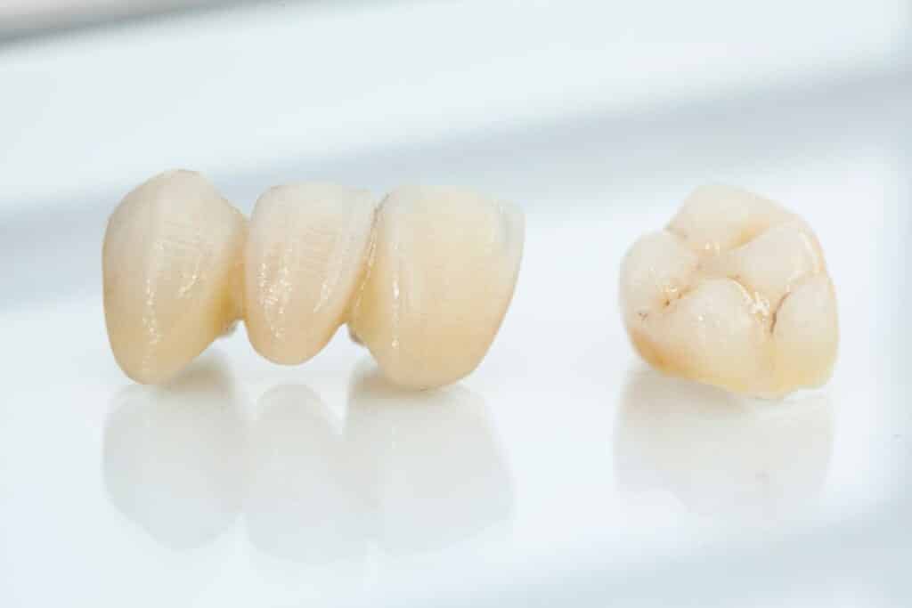 CEREC Crowns