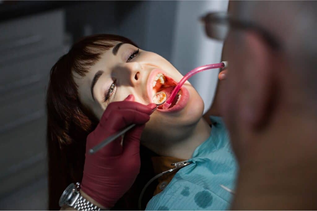 Can Dental Sealants Protect Teeth From Sugar Damage